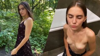 Lesníctvo končí lákavým teenagerom s škvrnou v tvári